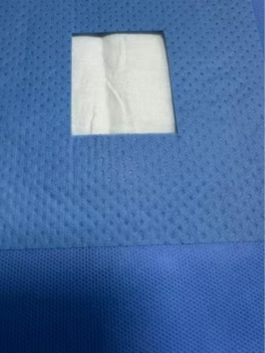 Disposable Surgical Drape - ЮйЧэнь