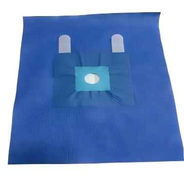 Disposable Sterile Fenestrated Surgical Drape with Tapes - ЮйЧэнь