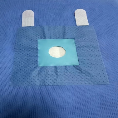 Disposable Sterile Fenestrated Surgical Drape with Tapes - ЮйЧэнь